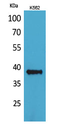 CD1C Rabbit Polyclonal Antibody