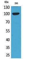 ENPP2 Rabbit Polyclonal Antibody