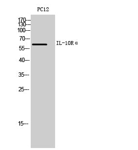 IL-10 Receptor alpha Rabbit Polyclonal Antibody