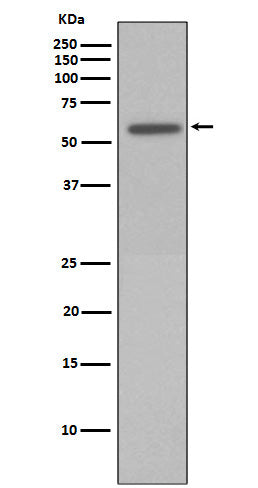 Phospho-Vimentin (Ser72) Rabbit Polyclonal Antibody
