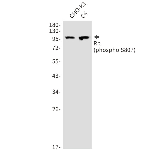 Phospho-Rb (Ser807) Rabbit Polyclonal Antibody