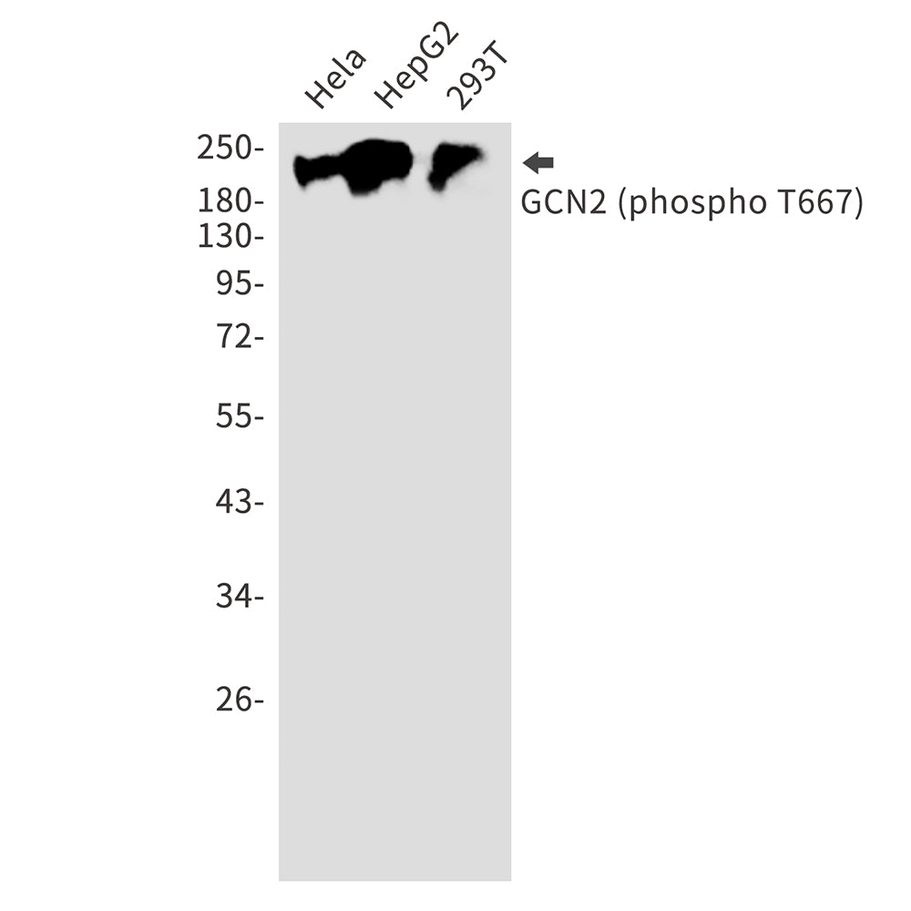 Phospho-GCN2 (Thr667) Rabbit Polyclonal Antibody