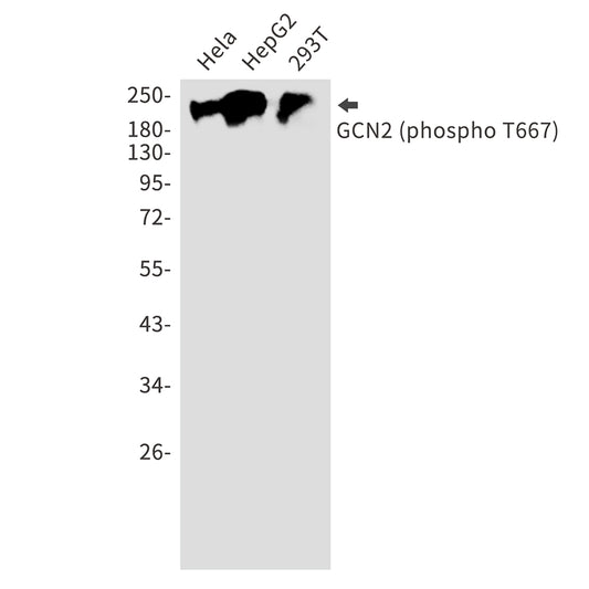 Phospho-GCN2 (Thr667) Rabbit Polyclonal Antibody