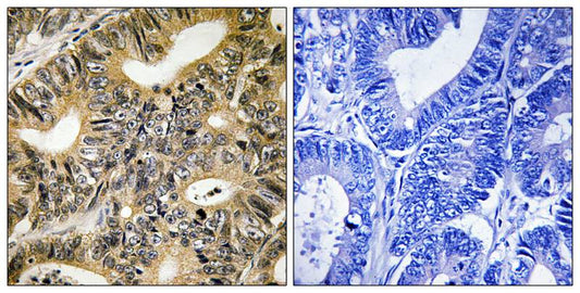 Phospho-4E BP1 (Thr70) Rabbit Polyclonal Antibody