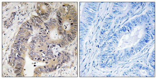 Phospho-CAD (Thr456) Rabbit Polyclonal Antibody