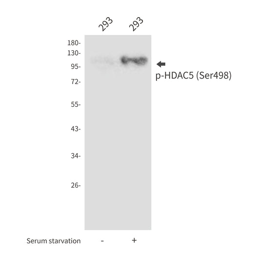 Phospho-HDAC5 (Ser498) Rabbit Polyclonal Antibody