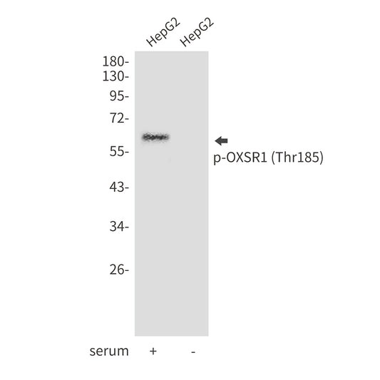 Phospho-OXSR1 (Thr185) Rabbit Polyclonal Antibody