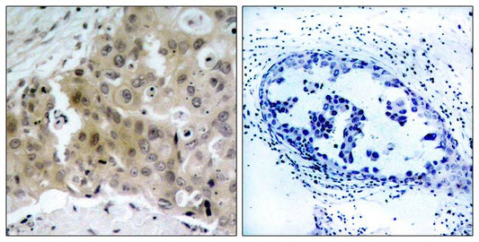 Phospho-VEGF Receptor 2 (Tyr1175) Rabbit Polyclonal Antibody