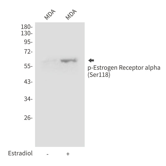 Phospho-Estrogen Receptor alpha (Ser118) Rabbit Polyclonal Antibody