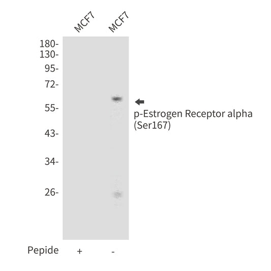 Phospho-Estrogen Receptor alpha (Ser167) Rabbit Polyclonal Antibody