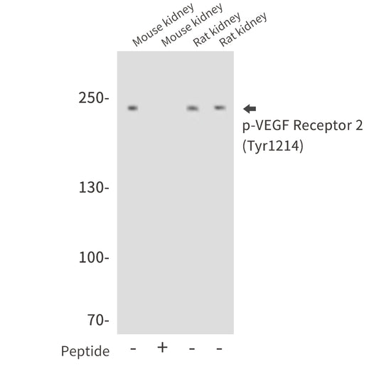 Phospho-VEGF Receptor 2 (Tyr1214) Rabbit Polyclonal Antibody