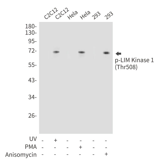 Phospho-LIM Kinase 1 (Thr508) Rabbit Polyclonal Antibody