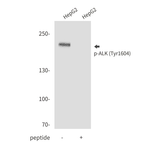Phospho-ALK (Tyr1604) Rabbit Polyclonal Antibody