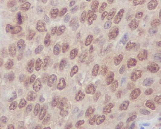 RhoA/B/C Rabbit Polyclonal Antibody