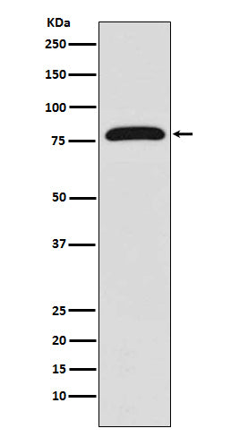 Transglutaminase 2 Rabbit Polyclonal Antibody
