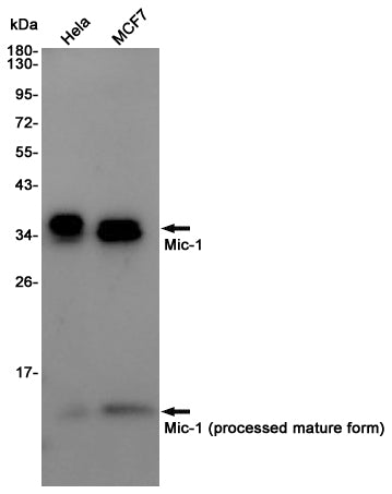GDF15 Rabbit Polyclonal Antibody