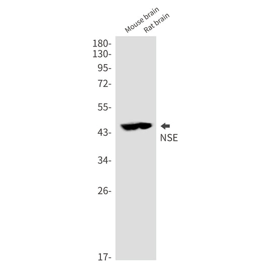 NSE Rabbit Polyclonal Antibody