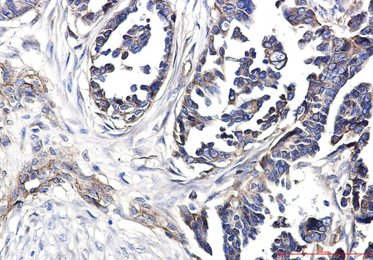 Integrin beta 1 Rabbit Polyclonal Antibody