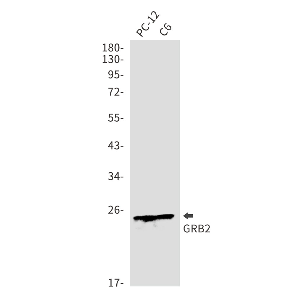 GRB2 Rabbit Polyclonal Antibody