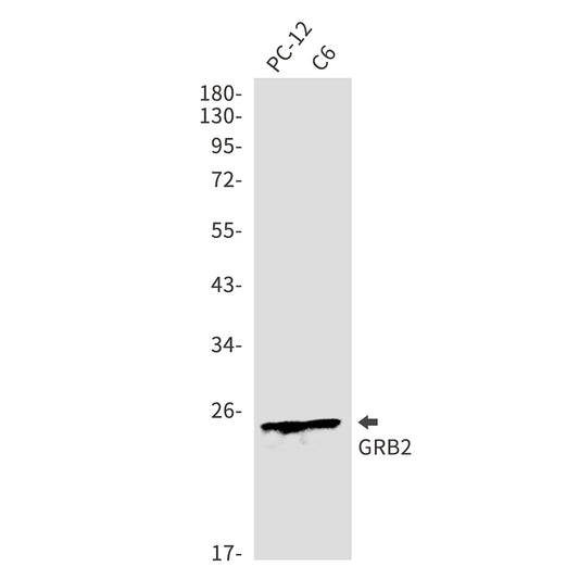 GRB2 Rabbit Polyclonal Antibody