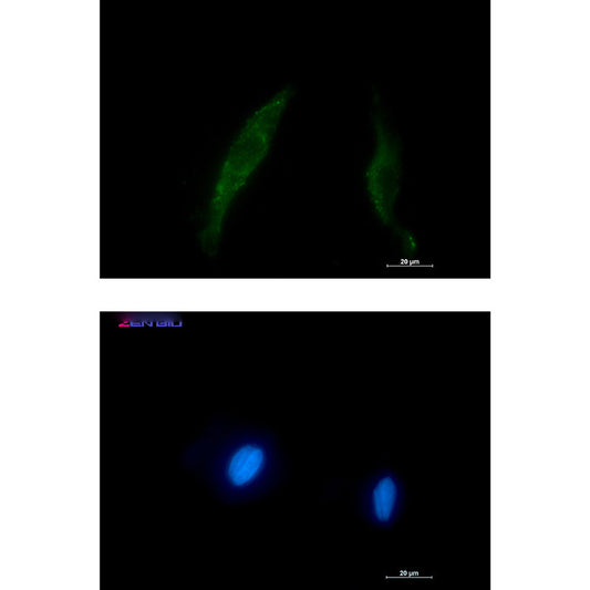 Smad2/3 Rabbit Polyclonal Antibody