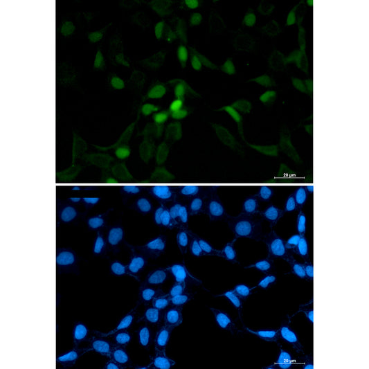 CDT1 Rabbit Polyclonal Antibody