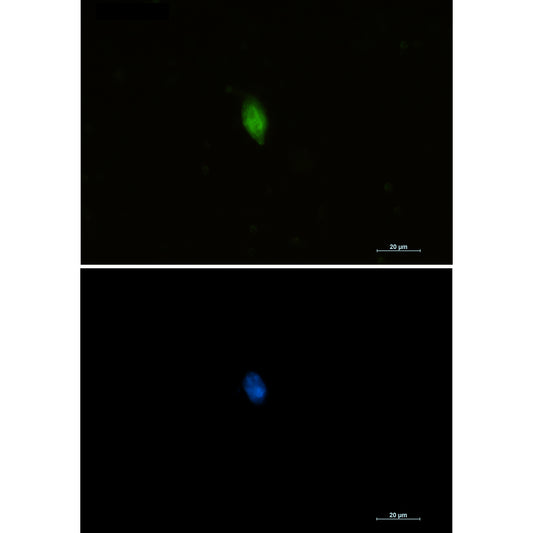 CDKN2A/p16INK4a Rabbit Polyclonal Antibody