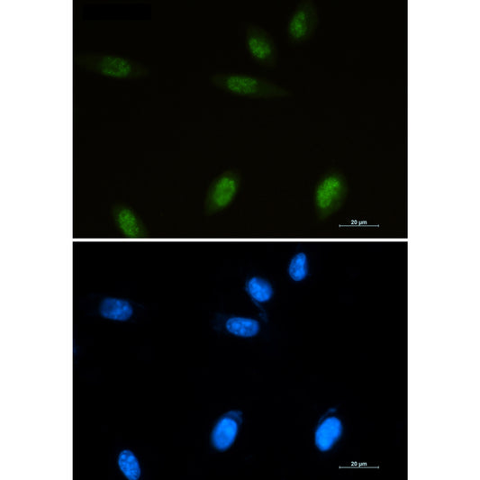 Islet 1 Rabbit Polyclonal Antibody