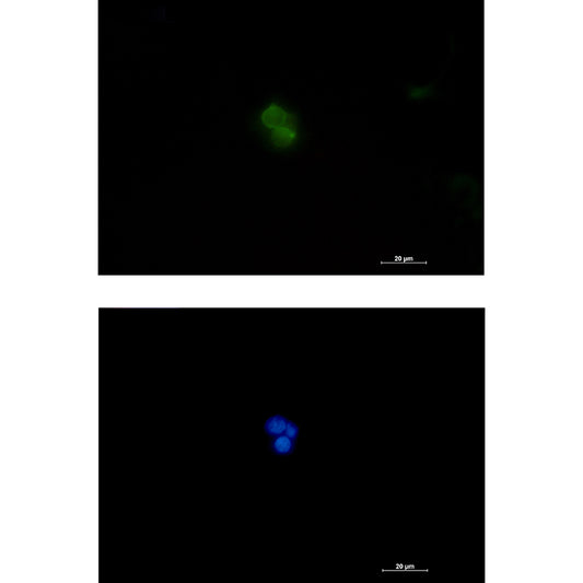 Plastin L Rabbit Polyclonal Antibody