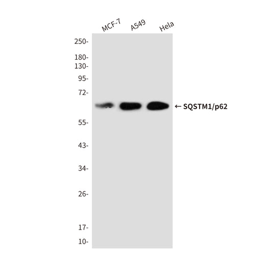 SQSTM1/p62 Rabbit Polyclonal Antibody
