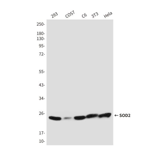 SOD2 Rabbit Polyclonal Antibody