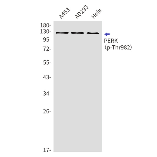 Phospho-PERK (Thr982) Rabbit Polyclonal Antibody