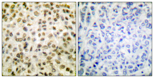 Acetyl Histone H1 (K25) Rabbit Polyclonal Antibody