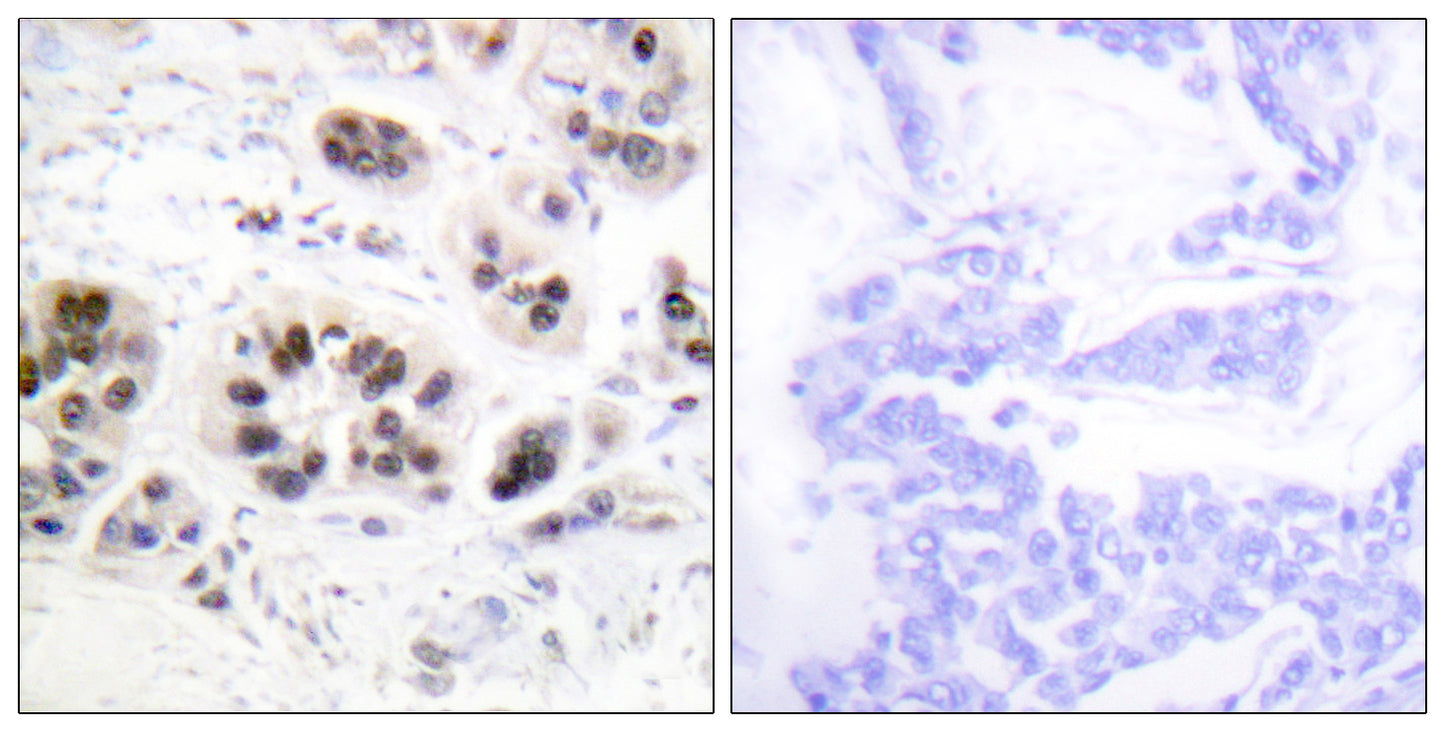 Acetyl Histone H2A (K5) Rabbit Polyclonal Antibody