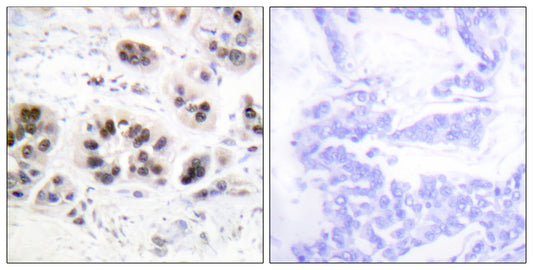 Acetyl Histone H2A (K5) Rabbit Polyclonal Antibody