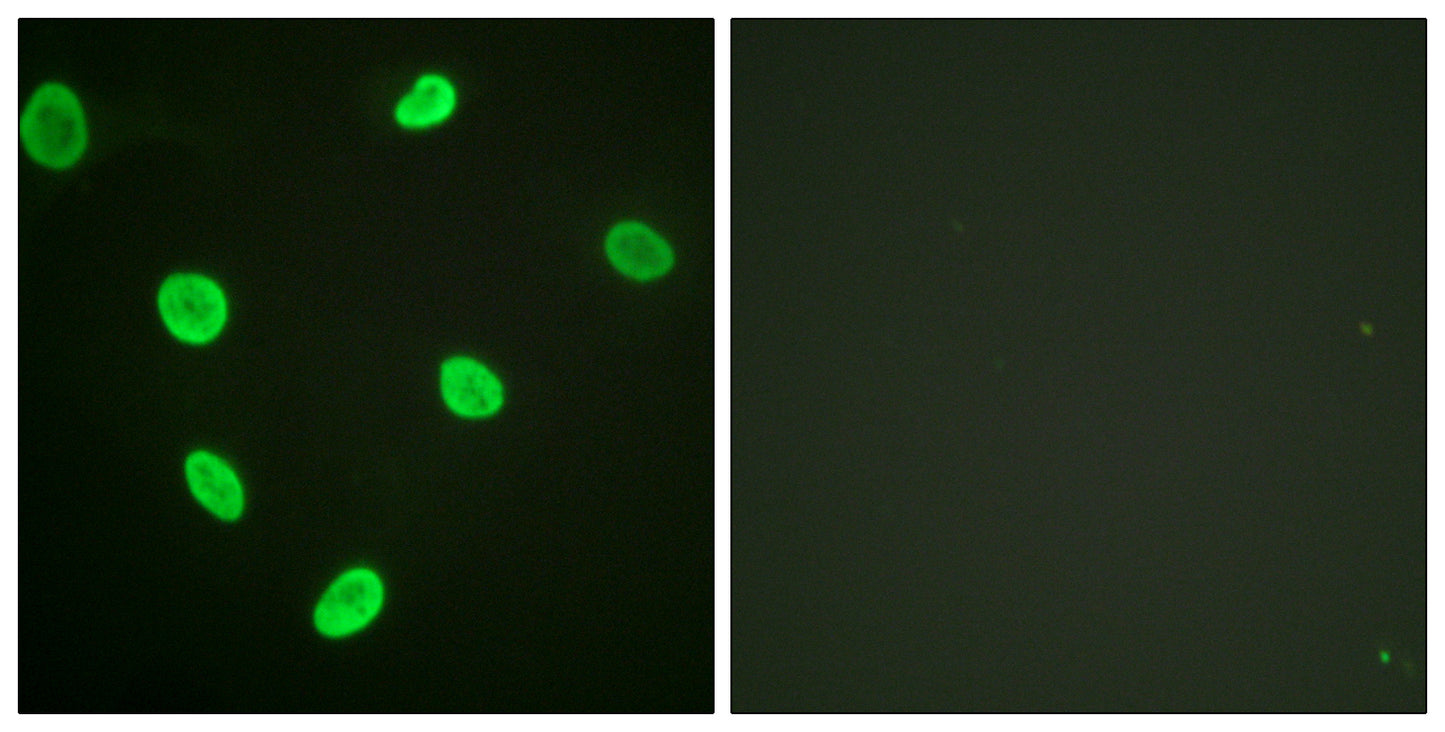 Acetyl Histone H2B (K12) Rabbit Polyclonal Antibody