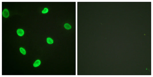 Acetyl Histone H2B (K12) Rabbit Polyclonal Antibody
