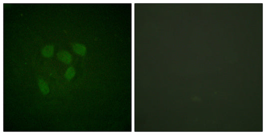 Acetyl p53 (K319) Rabbit Polyclonal Antibody