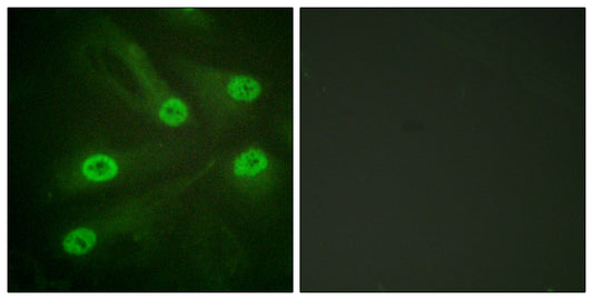 Acetyl p53 (K386) Rabbit Polyclonal Antibody