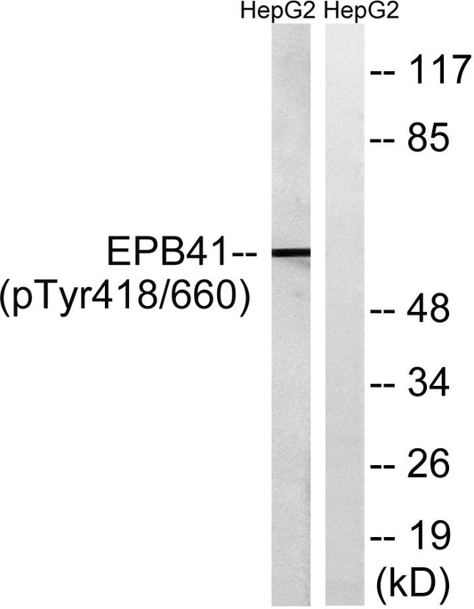 4.1R (phospho Tyr660) Rabbit Polyclonal Antibody