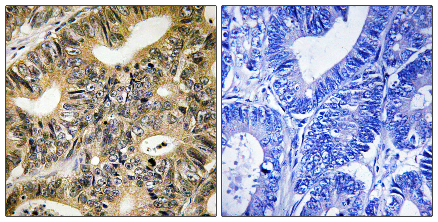 4E-BP1 (phospho Thr70) Rabbit Polyclonal Antibody