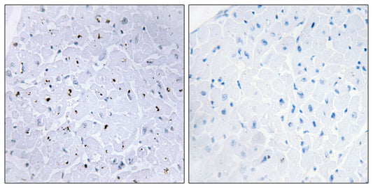 53BP1 (phospho Ser6) Rabbit Polyclonal Antibody