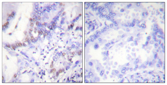 Abl1/2 (phospho Tyr393/439) Rabbit Polyclonal Antibody