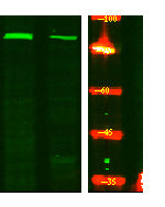 ACAP1 (phospho Ser554) Rabbit Polyclonal Antibody
