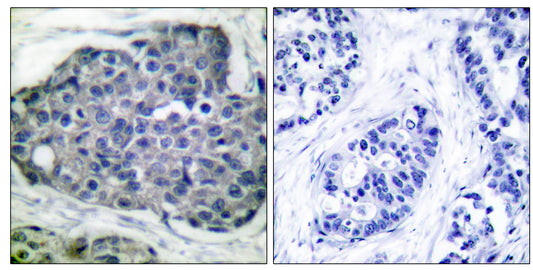 ACCα (phospho Ser80) Rabbit Polyclonal Antibody