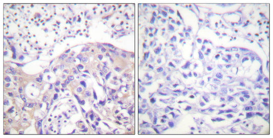 Adducin α (phospho Thr445) Rabbit Polyclonal Antibody