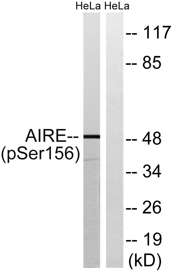 AIRE-1 (phospho Ser156) Rabbit Polyclonal Antibody
