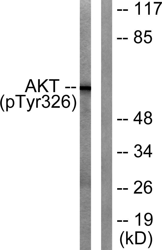 Akt (phospho Tyr326) Rabbit Polyclonal Antibody