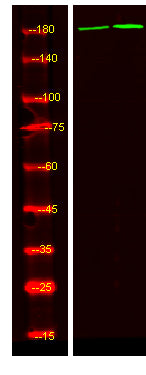 ALK (phospho-Tyr1078)  Rabbit Polyclonal Antibody