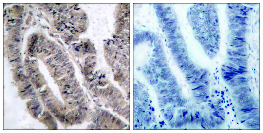 AMPKα1 (phospho Ser496) Rabbit Polyclonal Antibody